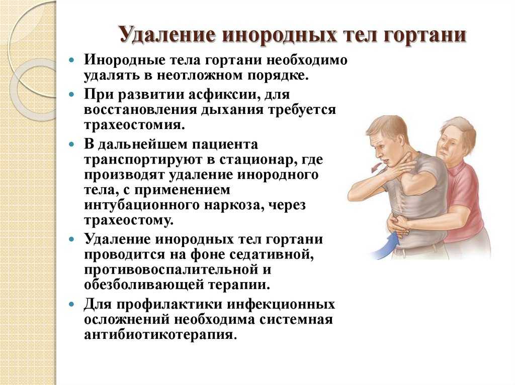 Инородное тело в кишечнике