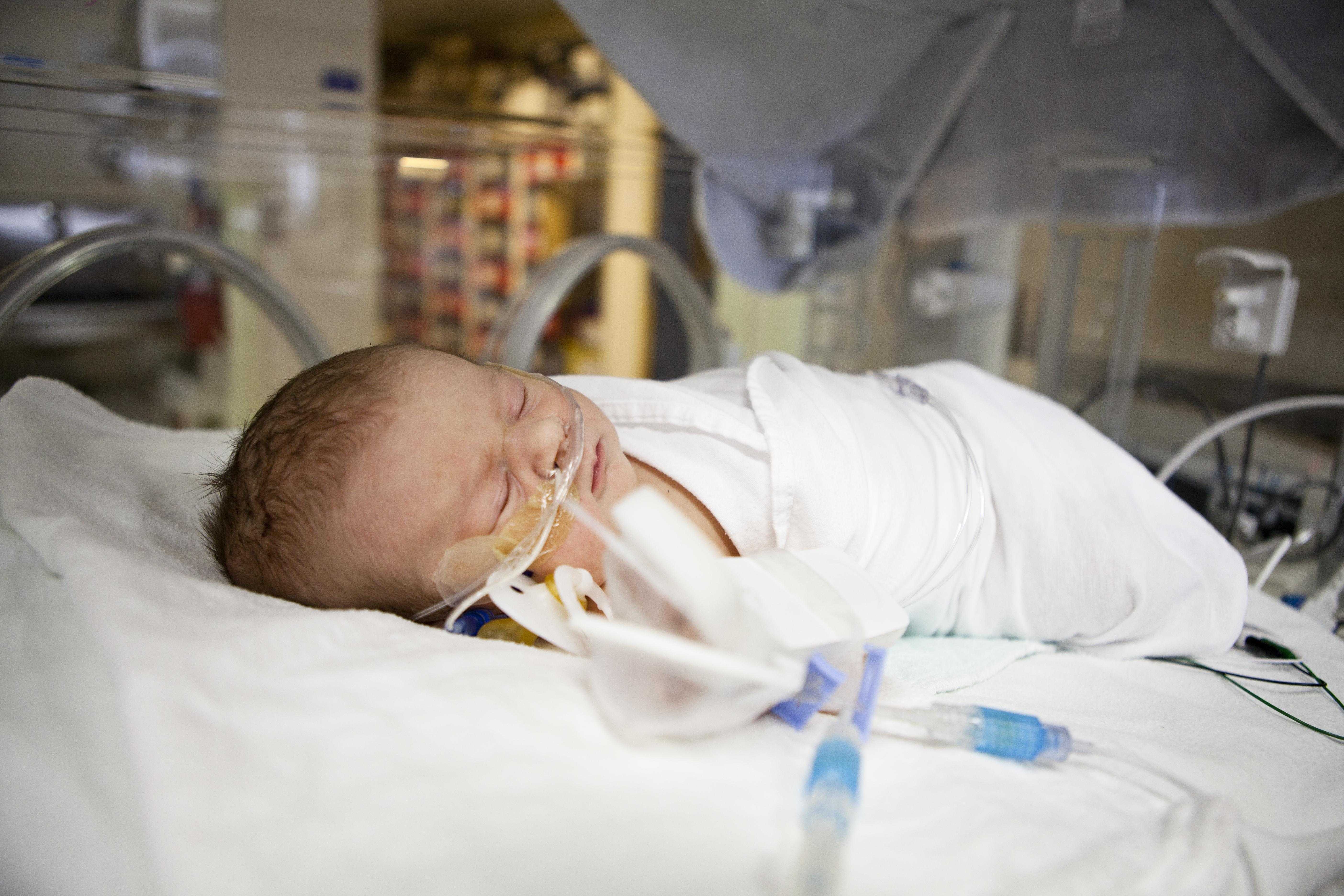 Новорожденный тяжело дышит. Новорожденный ребенок в реанимации. Пневмония у новорождённых детей. Новорожденный в больнице. Недоношенные дети в реанимации.