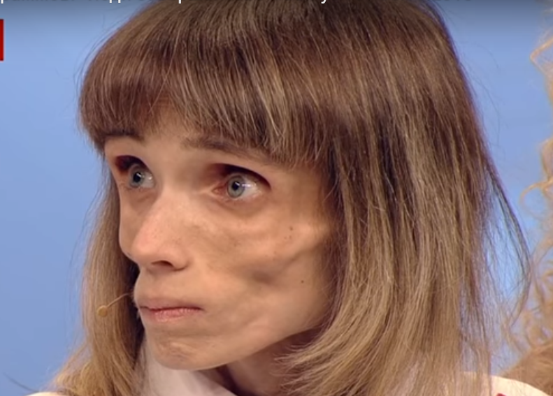 История кристины корягиной из программы «пусть говорят»: как сложилась ее судьба, анорексия, вес - 24сми