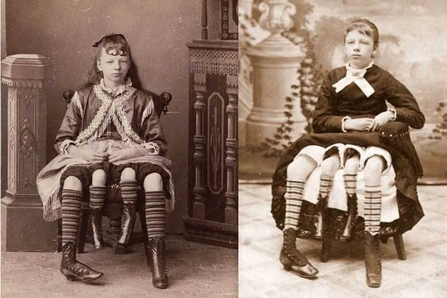 Неплакса миртл: как четырёхногая девочка-экспонат смогла войти в историю утончённой особой
