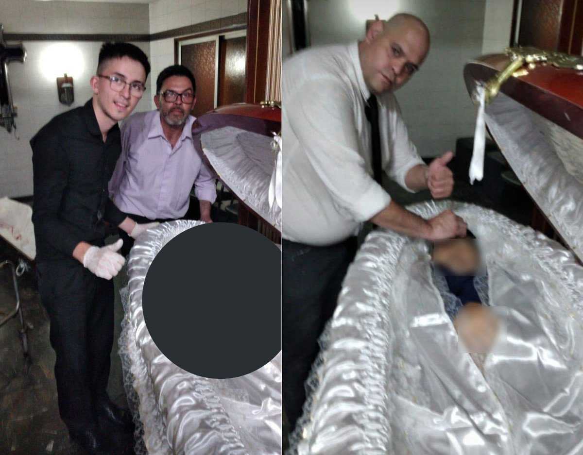 Какая болезнь патрика дюпона?