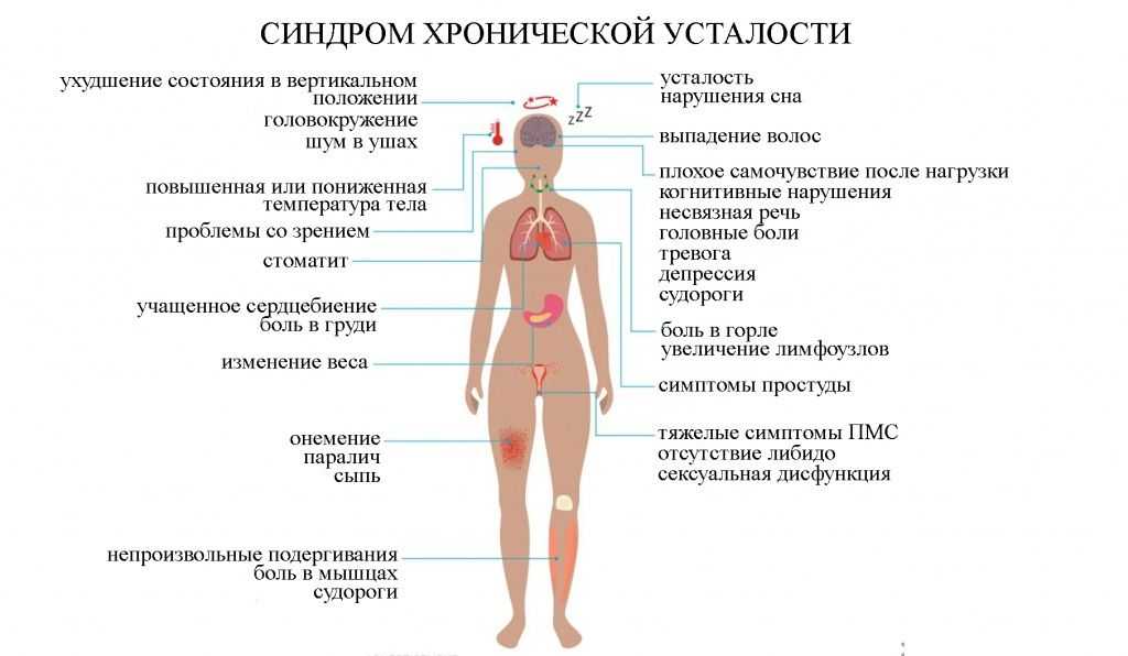 Синдром хронической усталости: неопределенная болезнь