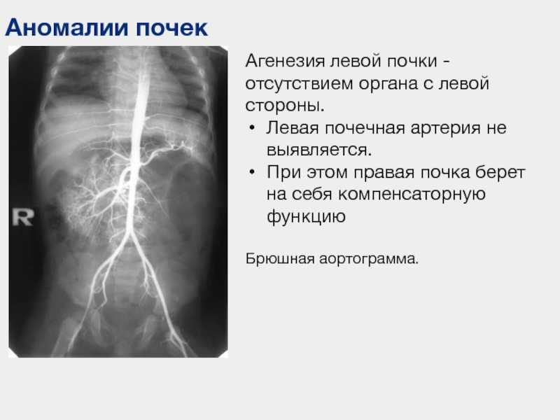 Тюмень — город исчезнувших детей | правмир