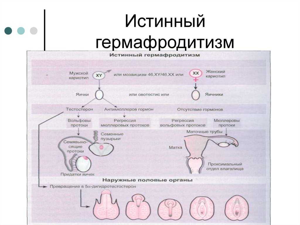 Гермафродиты: как на руси относились к «двуполым» людям — кириллица — энциклопедия русской жизни