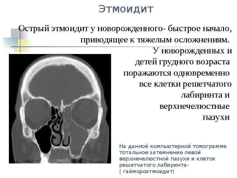 Увеличивается количество новых очень опасных грибковых инфекций | новости медицины