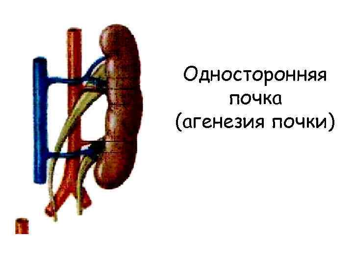 Тюмень — город исчезнувших детей | правмир