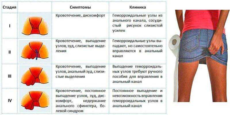 Как вылечить геморрой самостоятельно. рекомендации по питанию и образу жизни
