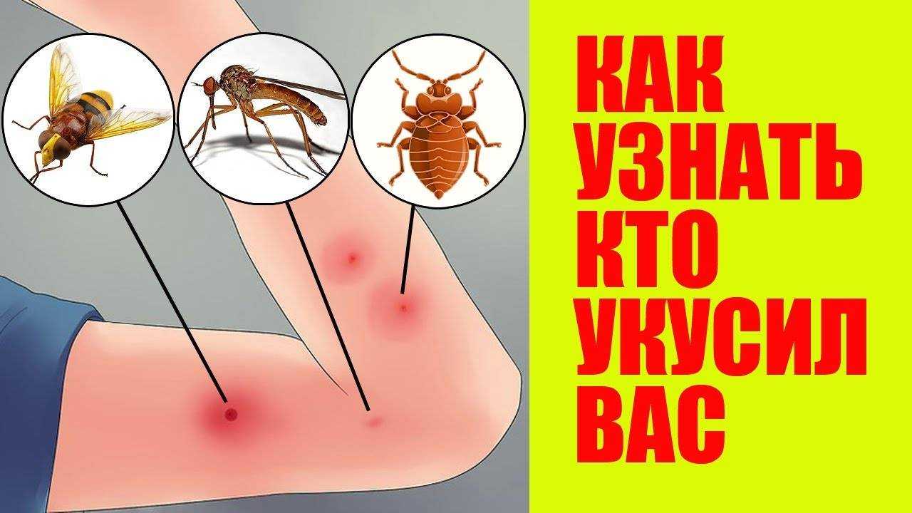 Почему мухи кусаются, особенно, в конце лета? / как избавится от насекомых в квартире