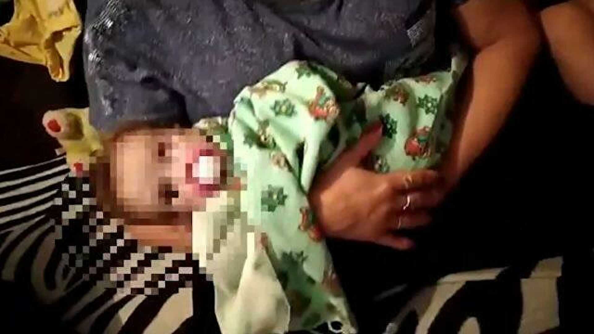 ребенок 6 месяцев упал с кровати синяк на лбу
