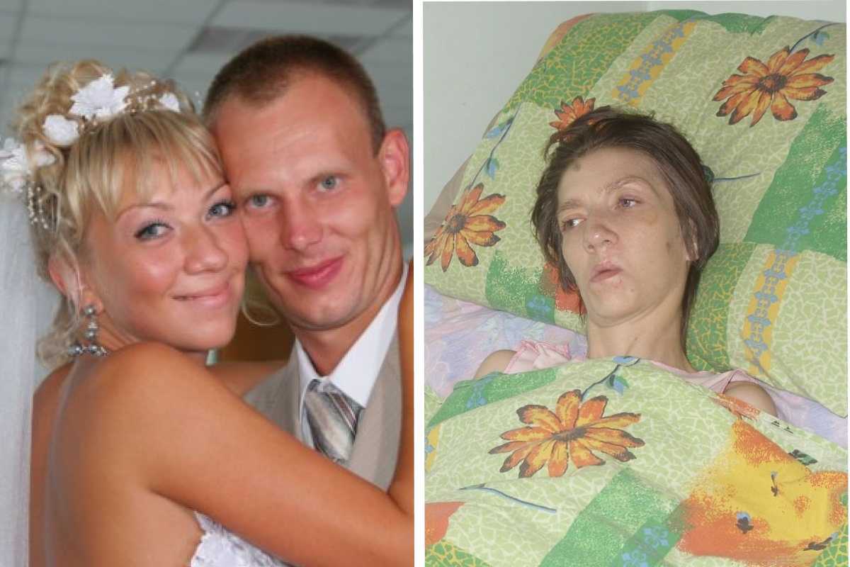 Десять лет спустя: как живёт одна из самых серьёзно пострадавших при пожаре в клубе «хромая лошадь»