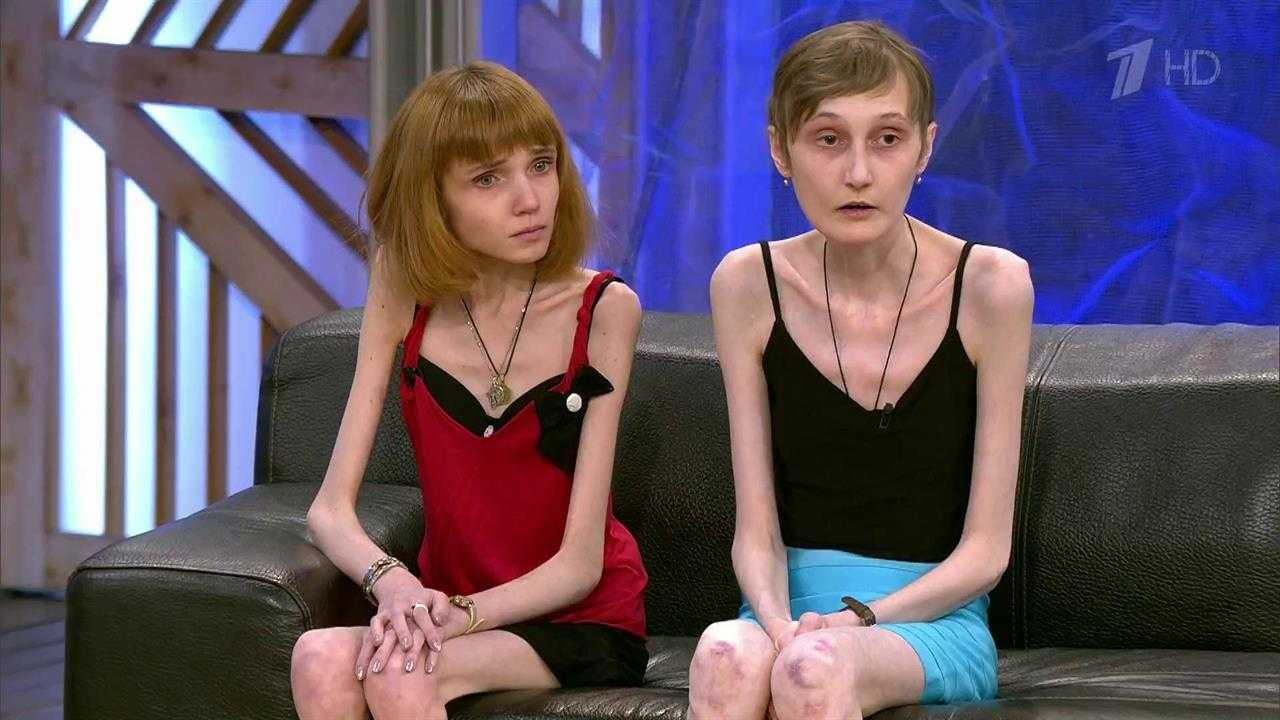 Что случилось с кристиной корягиной, похудевшей до 17 кг, и как она живет сейчас