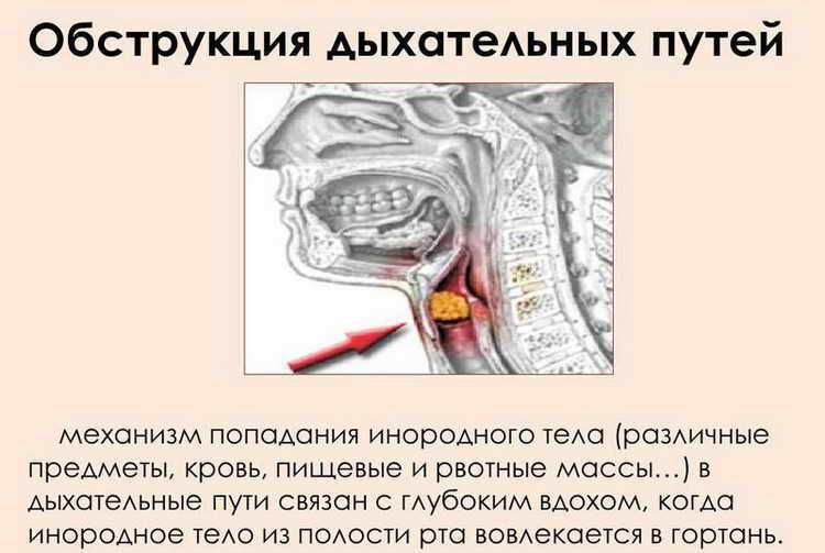 Инородные тела глотки, пищевода, гортани, трахеи и бронхов