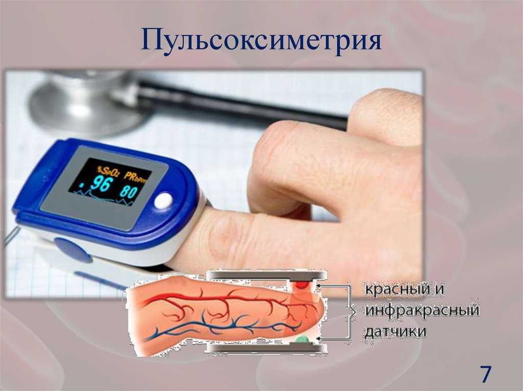 Пульсоксиметрия: техника и методика проведения, виды, показания и противопоказания к исследованию