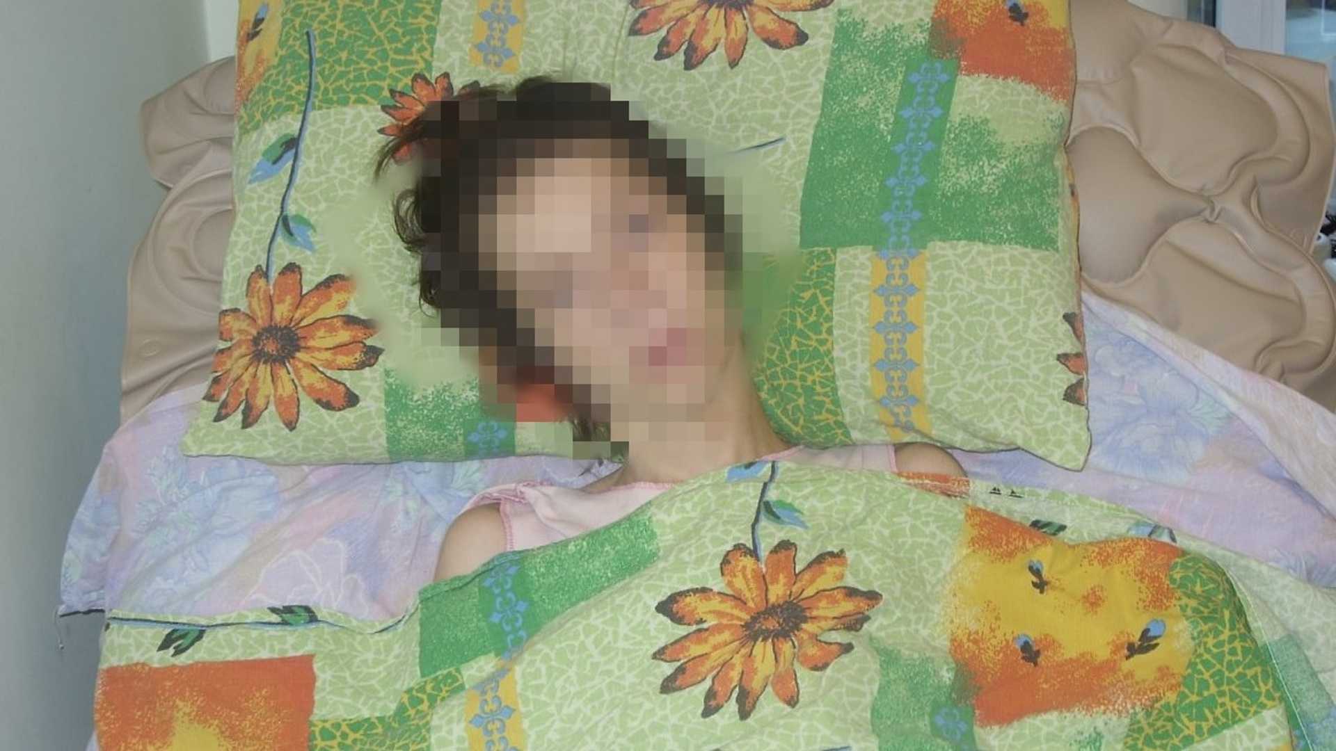 Десять лет спустя: как живёт одна из самых серьёзно пострадавших при пожаре в клубе «хромая лошадь» — рт на русском
