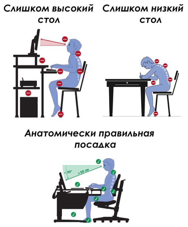 Спина колесом: как исправить осанку?